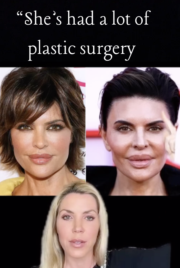 How much plastic surgery has Lisa Rinna had? Dr. Jen Armstrong weighs in